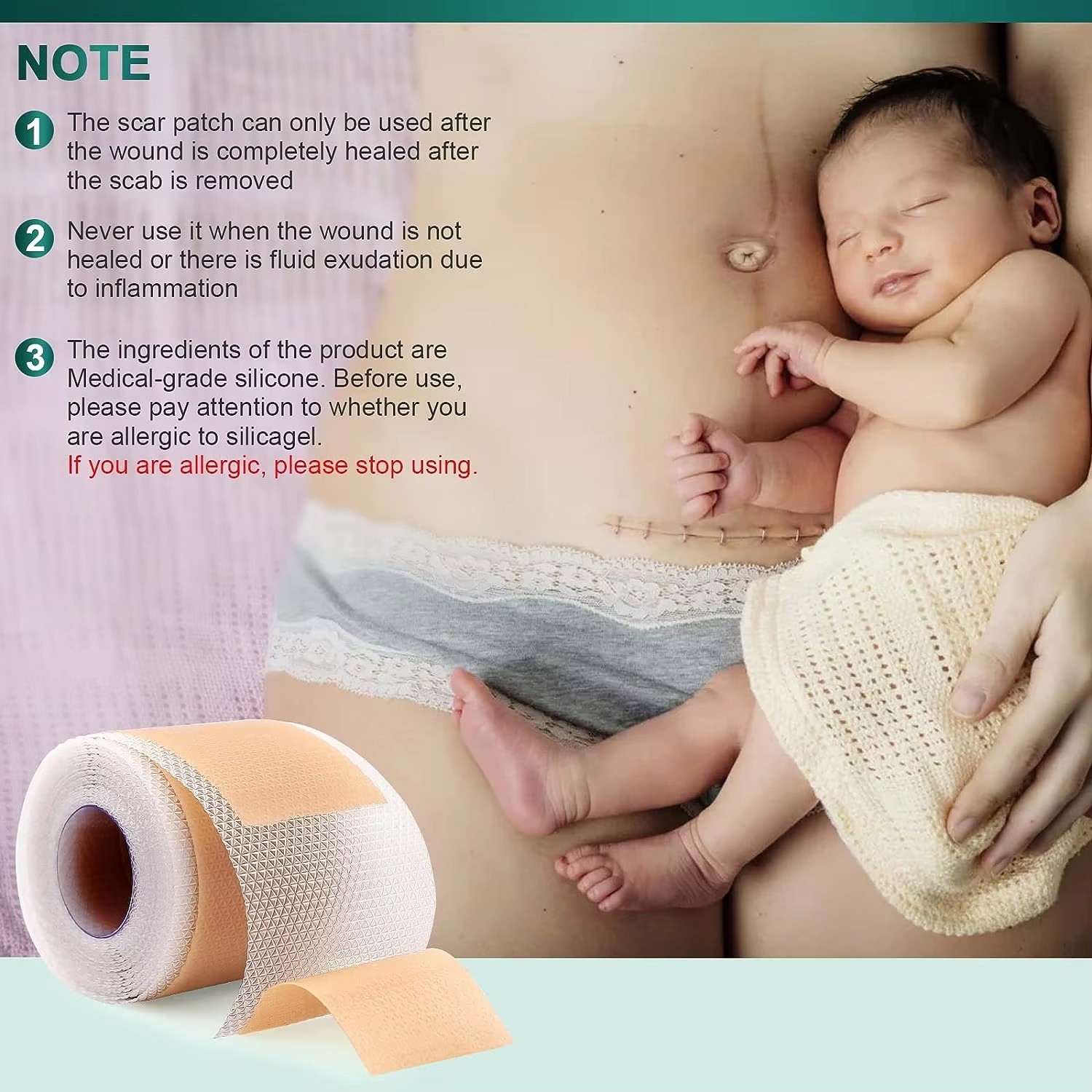 50/100/150cm Plester Silikon G - Medical Tape ulasan dan harga