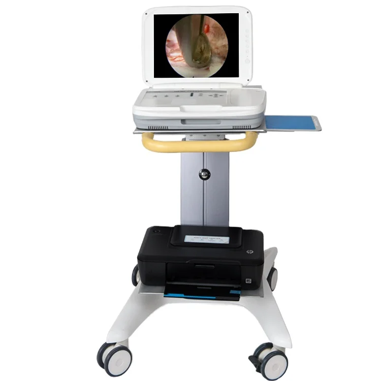 Sistem Endoskop Portabel Terin - Medical Lab Images ulasan dan harga