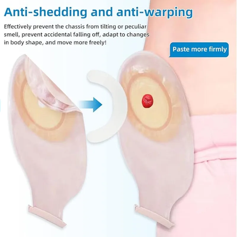 Pita Penguat Kantong Ostomi Me - Medical Tape ulasan dan harga